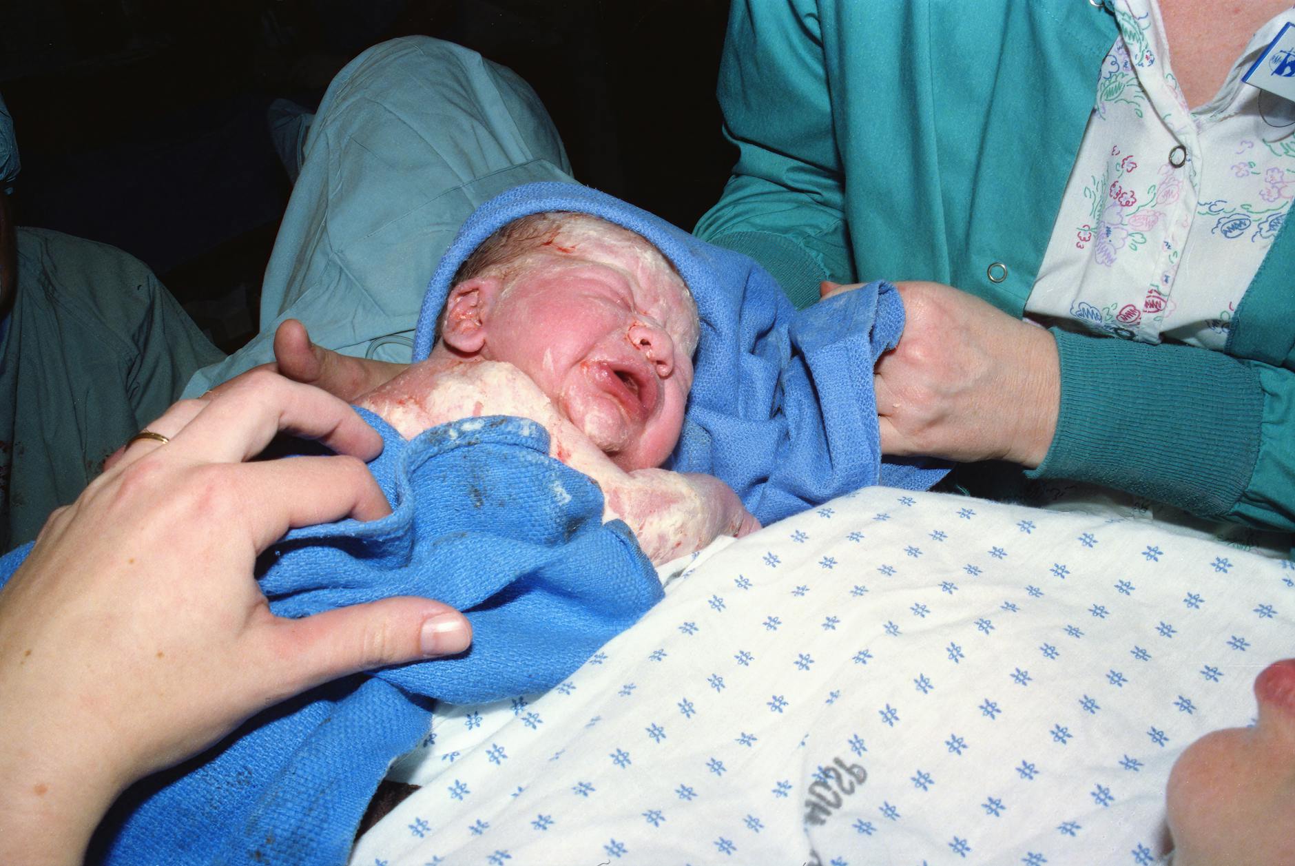 Birth