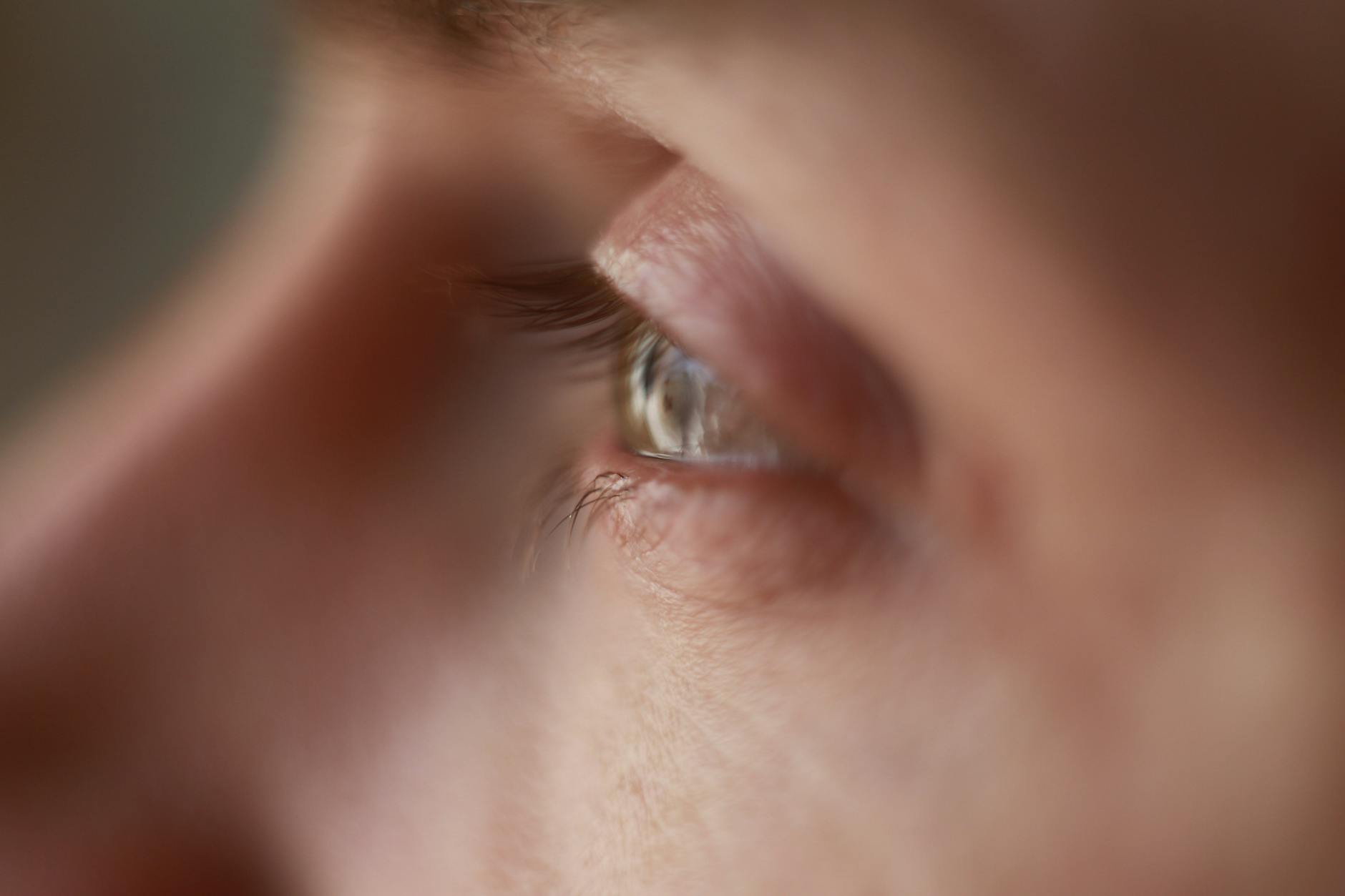 Feature