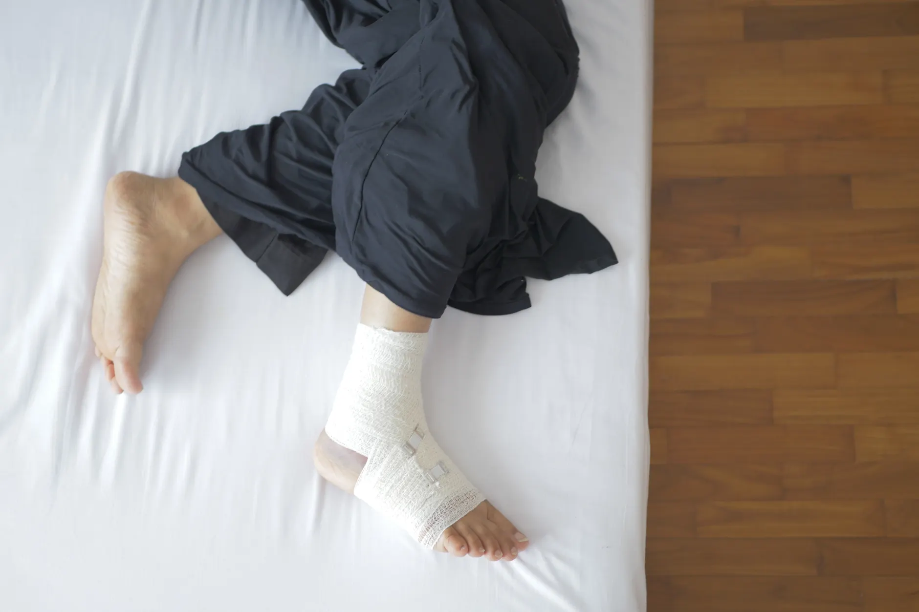 Fracture
