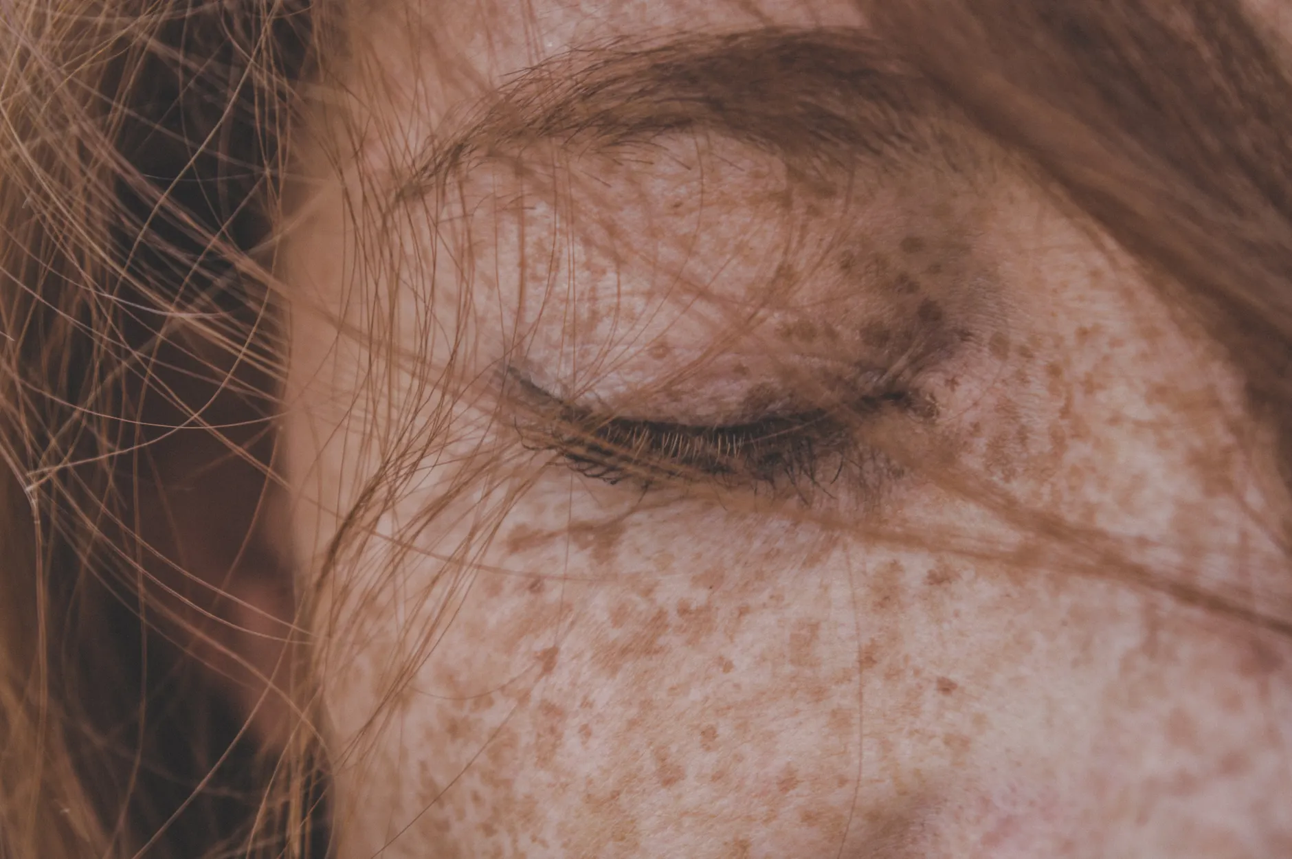 Freckles (веснушки) — маленькие коричневые пятнышки на коже