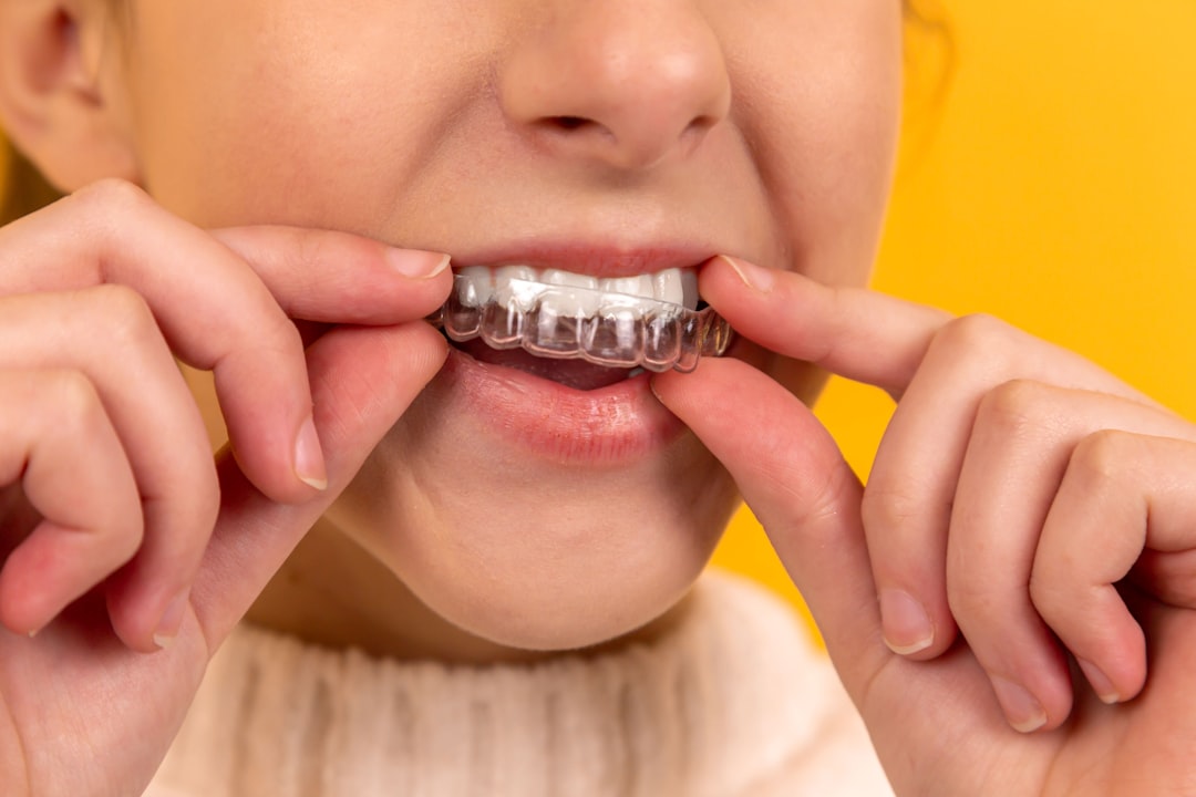 Retainer (Фиксатор, аванс) — устройство для зубов или плата за услуги